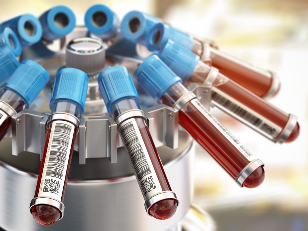 blood-test-tubes-in-centrifuge-medical-laboratory-CWURQ2F-scaled.jpg?strip=all&lossy=1&fit=1200%2C900&ssl=1